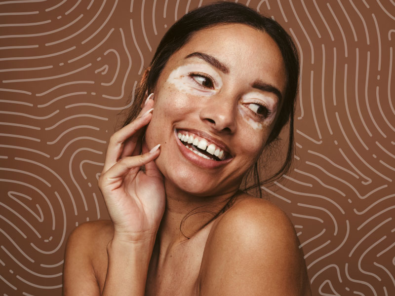 AssuredPartners-Cosmetic-Insure-homepage-image-800×600-1