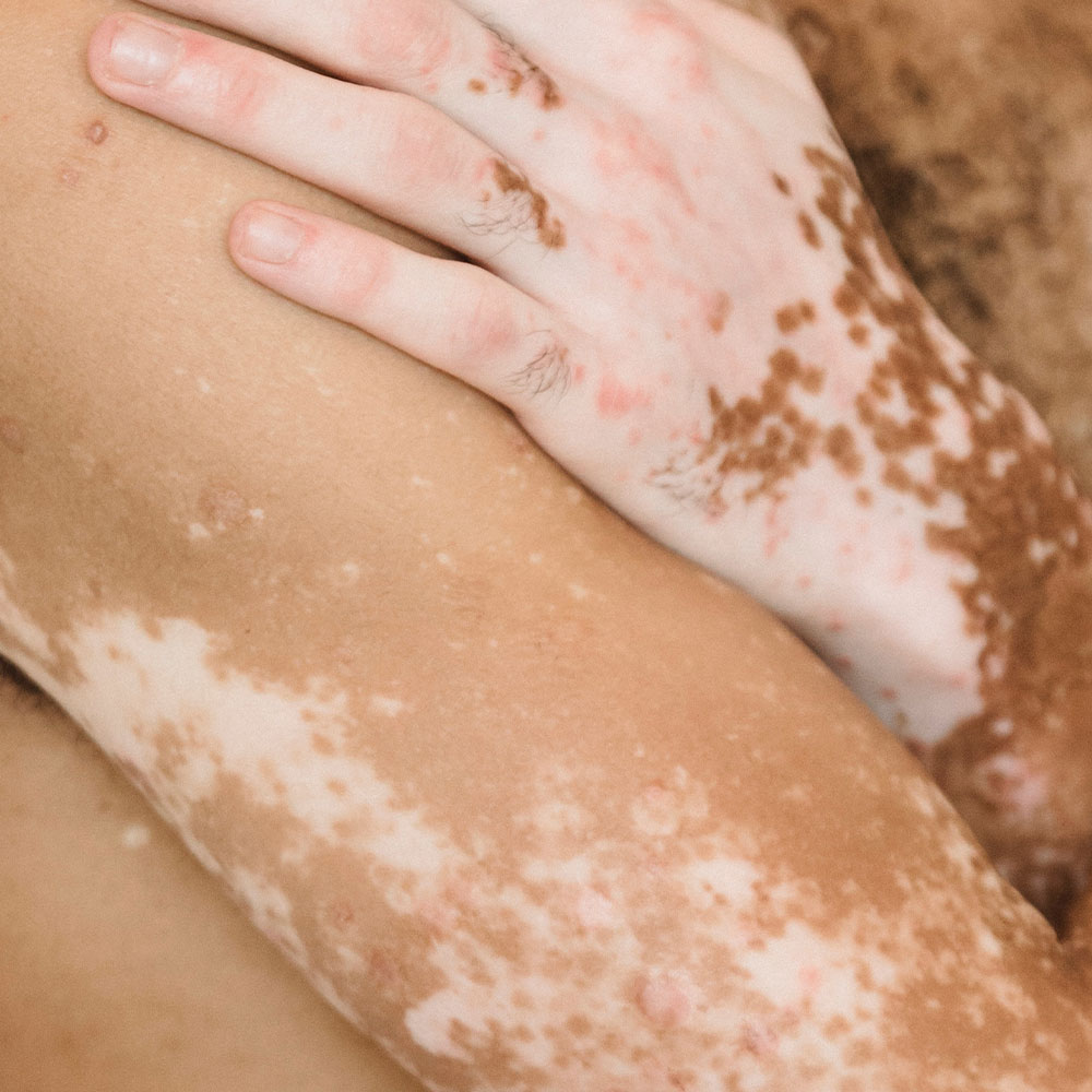 CosmeticInsure-AestheticInsurance-1000×1000-11