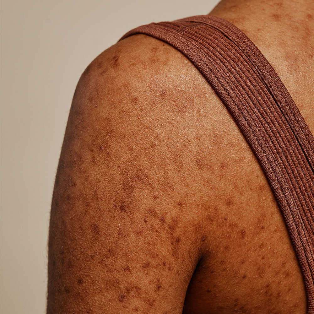 Managing Complaints in Aesthetic Practice