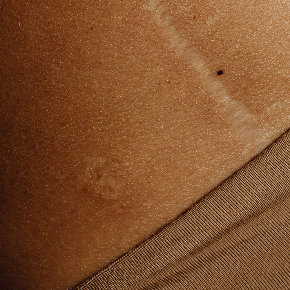 Minimising Risks in Aesthetic Practice