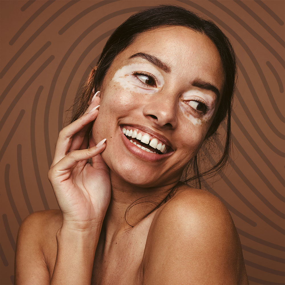 CosmeticIsnure-Partnership-Coherant3 Coherent Healthcare Partnership with Cosmetic Insure